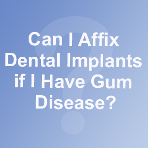 Can I Affix Dental Implants if I Have Gum Disease?