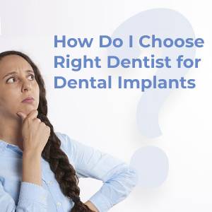 How Do I Choose the Right Dentist for Dental Implants?