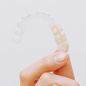 Can You Use Invisalign On Dental Implants? | Stuart, FL