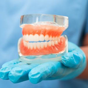 Dental professional holding a denture model for dentures in Stuart consultation