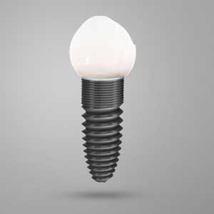 The need for dental implants