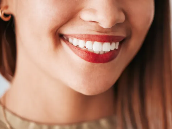 Teeth Whitening